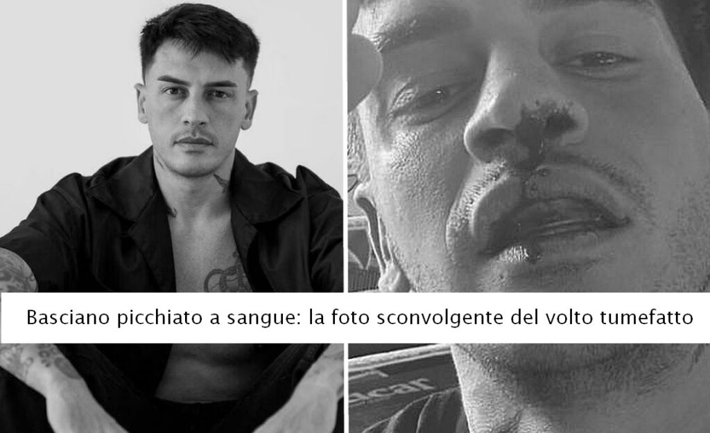 Alessandro Basciano picchiato a sangue. La foto sconvolgente del volto tumefatto